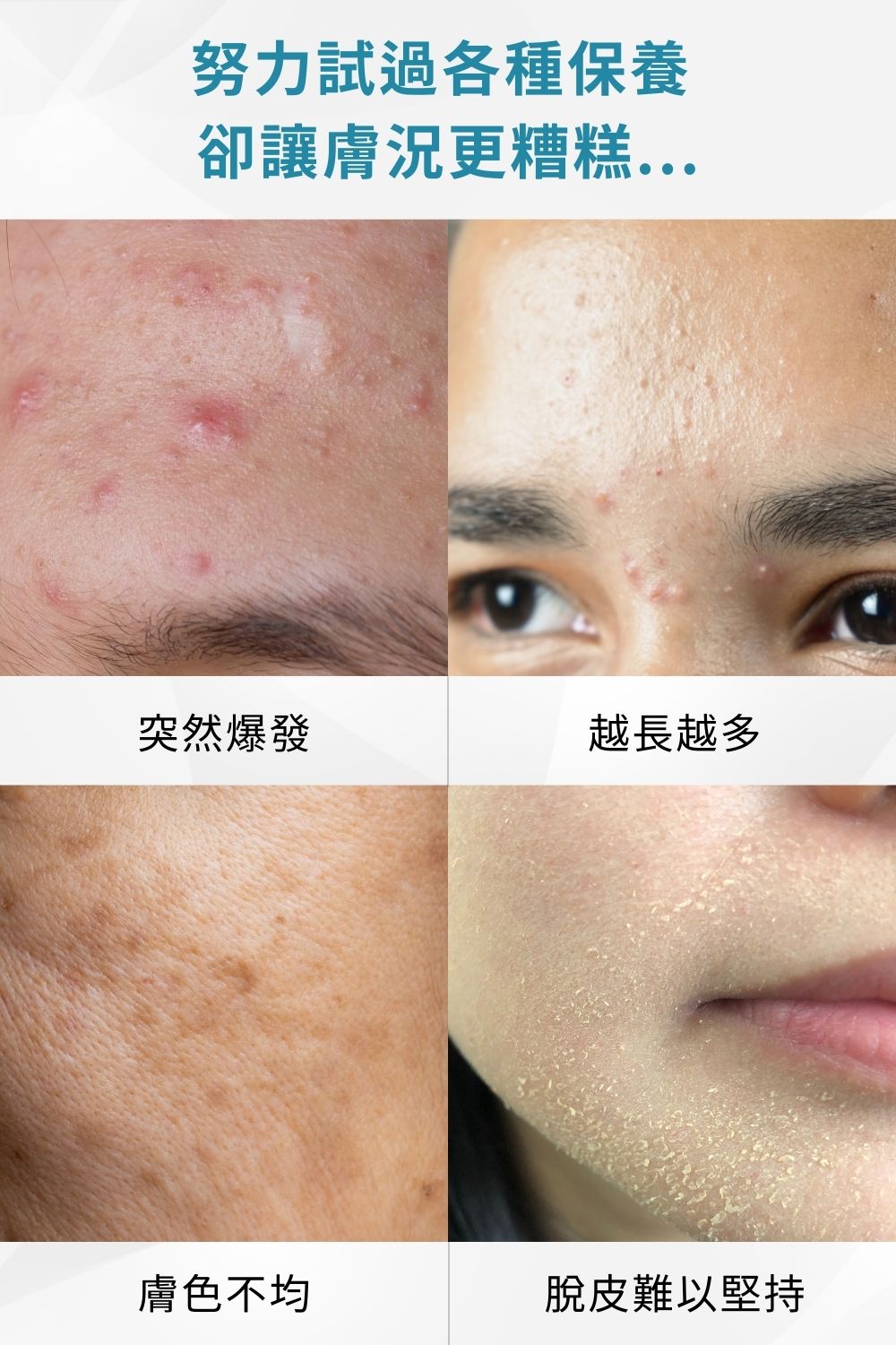 DRX達特仕的肌膚護理活動專區系列-極速祛痘超級亮膚組，5大控油成分、緊緻毛孔─拍照新動力，加強控油、面皰預防，提亮且保護肌膚，讓肌膚更提亮，極速祛痘超級亮膚組是你的好選擇。