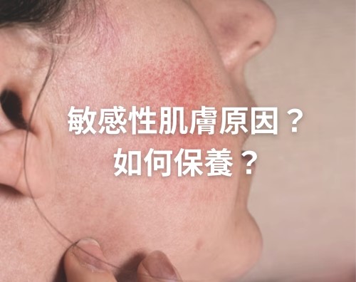 敏感性皮膚產生的原因？敏感肌如何保養？