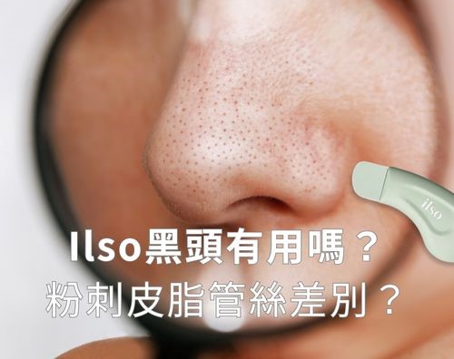 Ilso黑頭有用嗎？粉刺、皮脂管絲差別？