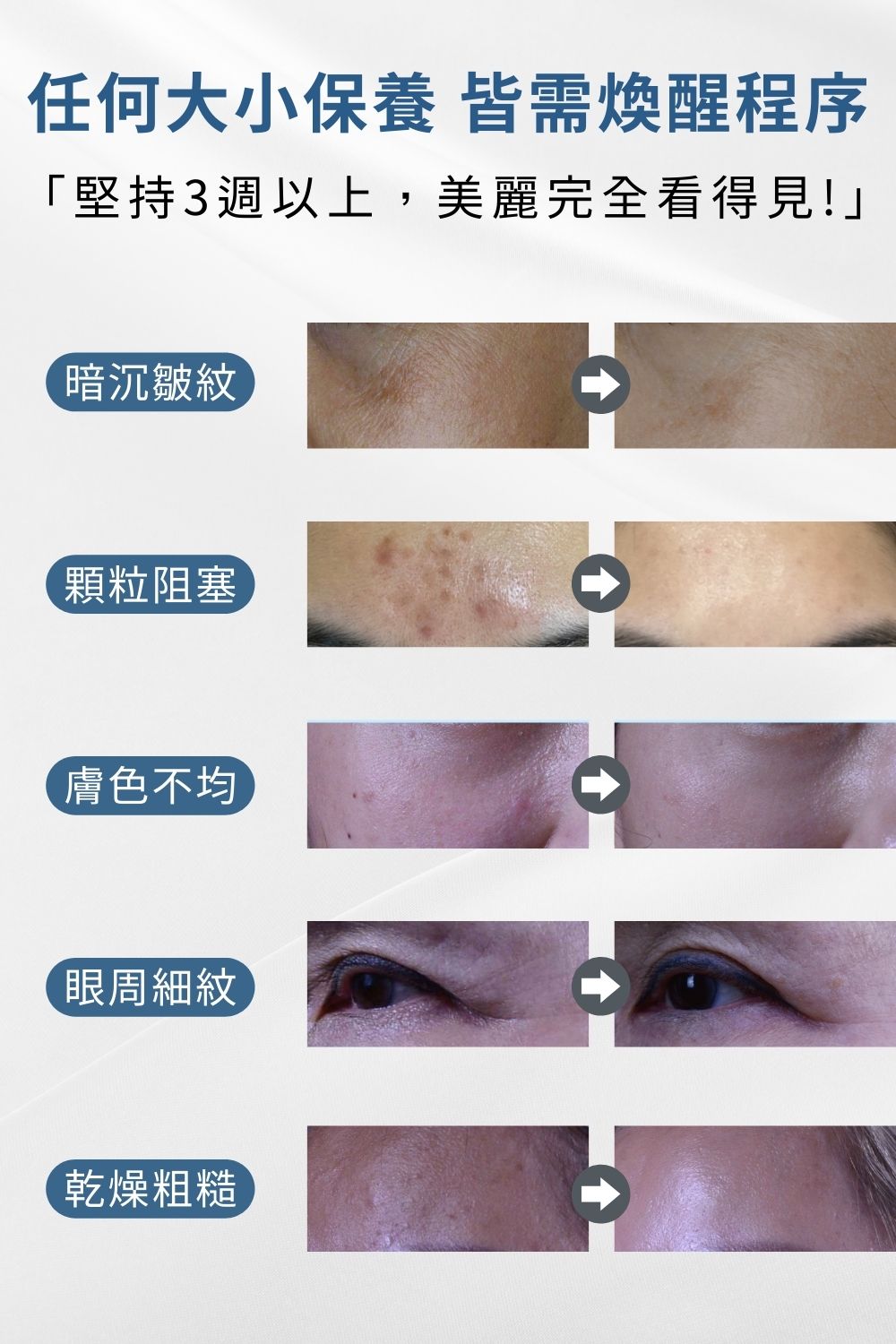 痘疤女王莊醫師打造A+C 醇淨步驟的保養程序，養膚前使用〈鎂Ｃ磨砂膏〉徹底清潔肌膚與〈2%水楊酸面膜〉呵護調理，再搭配淡化細紋和均勻提亮膚色的〈1%煥顏A醇〉完成煥膚保養工序，持續使用21天輕鬆找回美肌光韻。