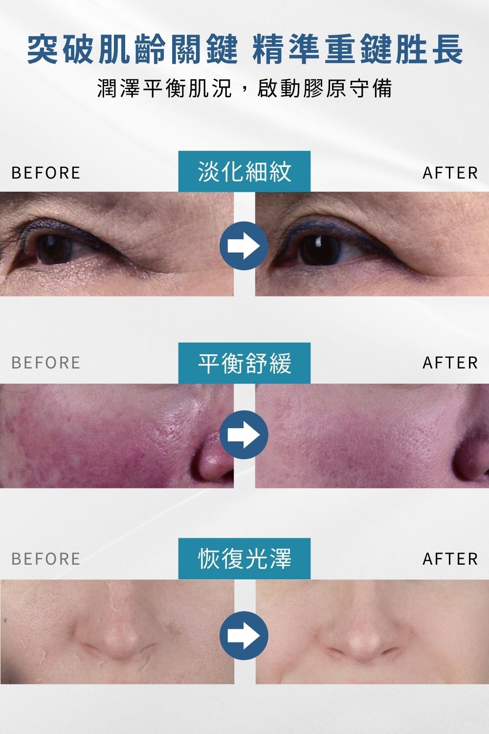今天不脫皮只想維持健康膚質的基礎抗老，選擇淡化細紋和均勻提亮膚色〈EGF撫紋多胜肽因子〉搭配〈退紅肌膚修護因子〉舒緩因肌膚乾燥引起的泛紅及深度保濕，適合所有特殊膚質。母親節限時7折搶購，限量50組！