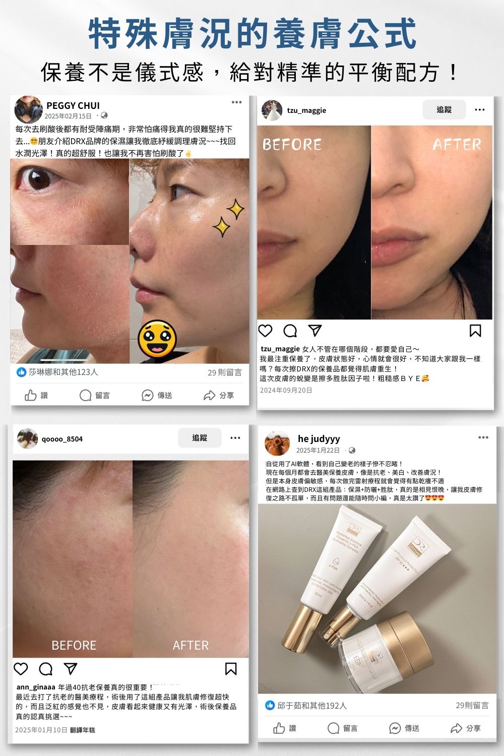 今天不脫皮只想維持健康膚質的基礎抗老，選擇淡化細紋和均勻提亮膚色〈EGF撫紋多胜肽因子〉搭配〈退紅肌膚修護因子〉舒緩因肌膚乾燥引起的泛紅及深度保濕，適合所有特殊膚質。母親節限時7折搶購，限量50組！