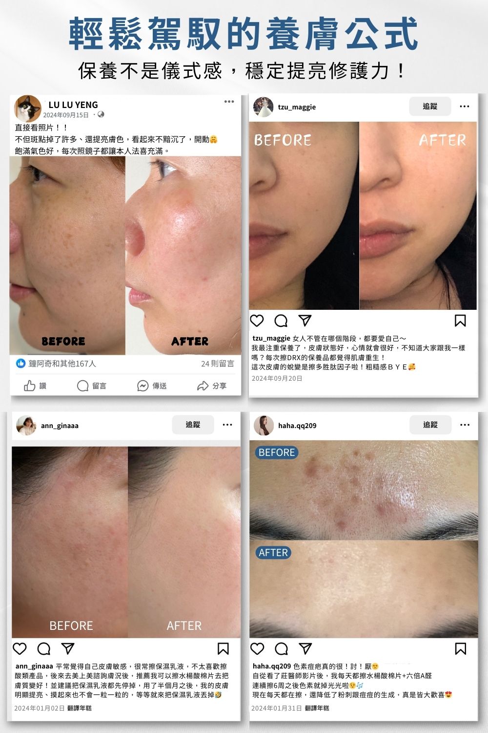正值特殊或煥膚期間難以照顧膚況變化，修復耐受重建急需調理呵護，平衡肌況不可或缺的成分，溫和保養〈超酵A醛〉搭配〈退紅肌膚修護因子〉舒緩因肌膚乾燥引起的泛紅及深度保濕，適合所有特殊膚質。母親節限時7折搶購，限量50組！