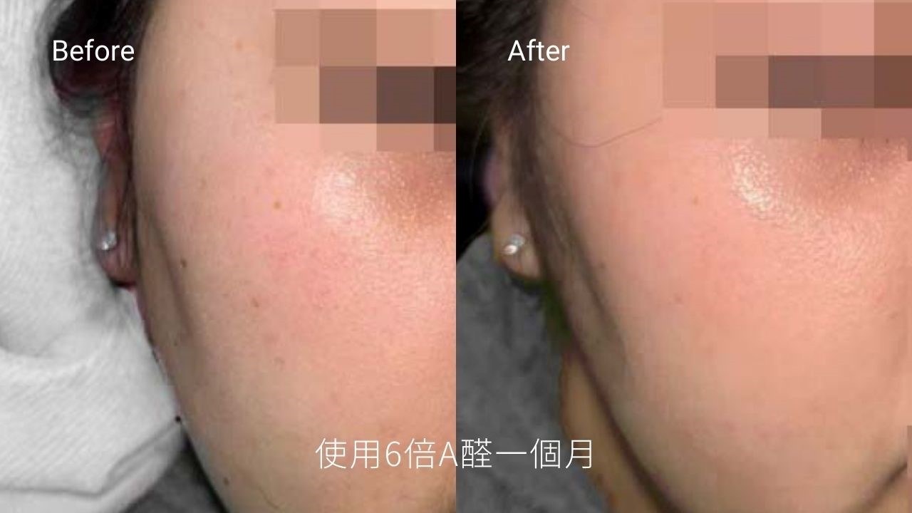 A醇入門！A醇濃度越高越好嗎？