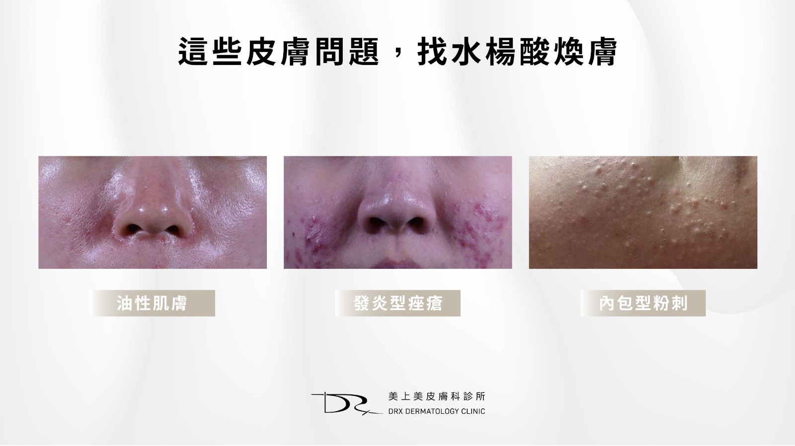杏仁酸不能和什麼一起用？杏仁酸能和水楊酸一起用？