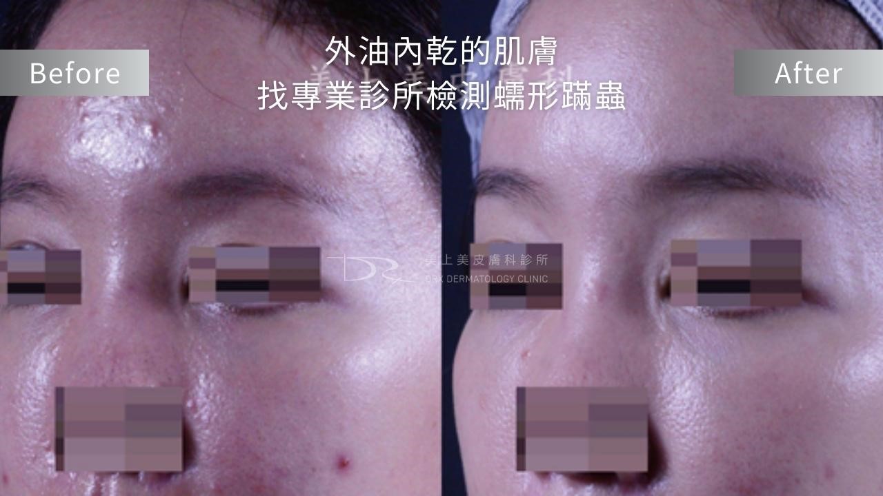 保養品擦了都沒用？5招教你秒改善！跟吸收不進去說掰掰