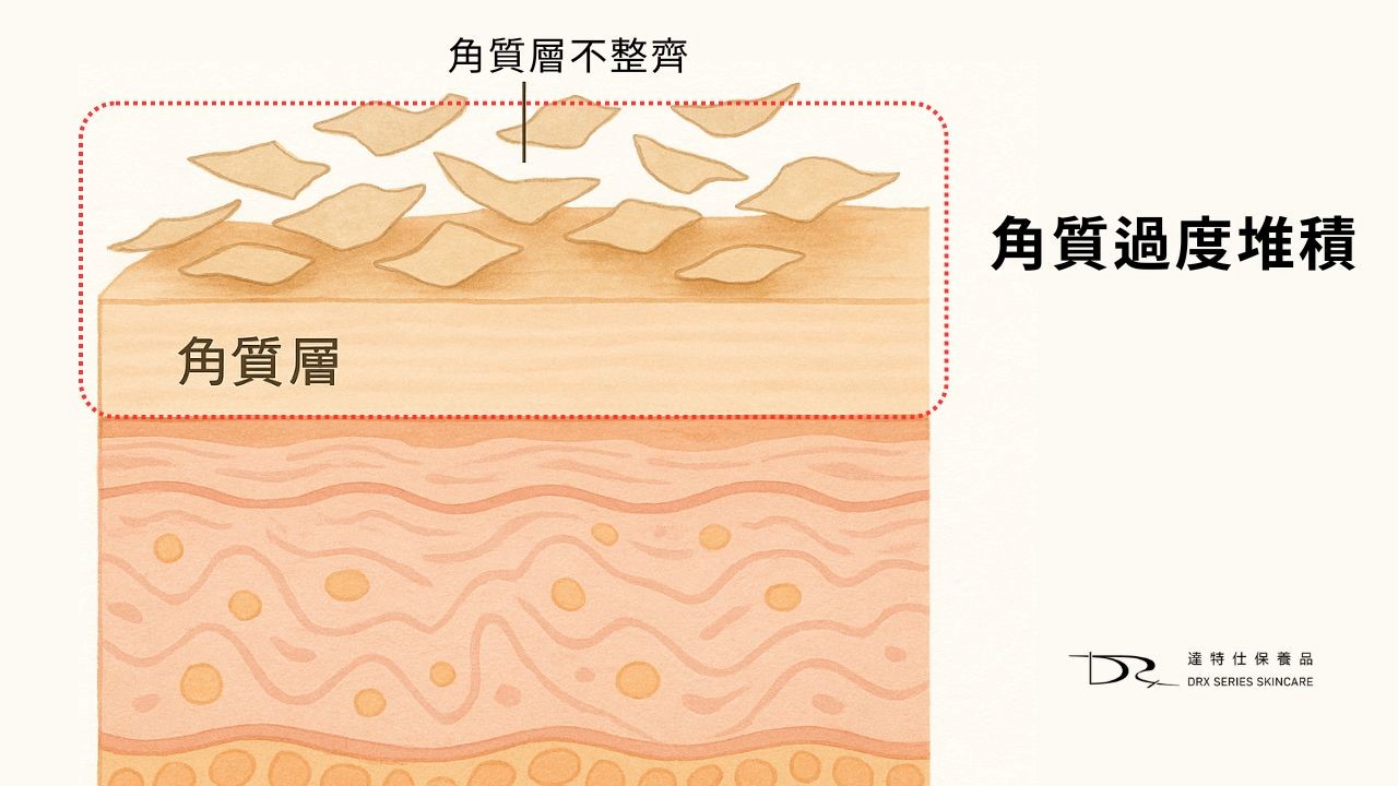 皮膚為什麼會乾癢？皮膚保濕推薦！