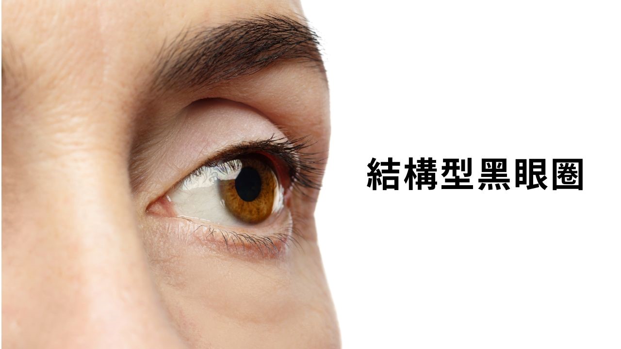 咖啡因眼霜對黑眼圈有效嗎？5種黑眼圈類型眼霜選購指南
