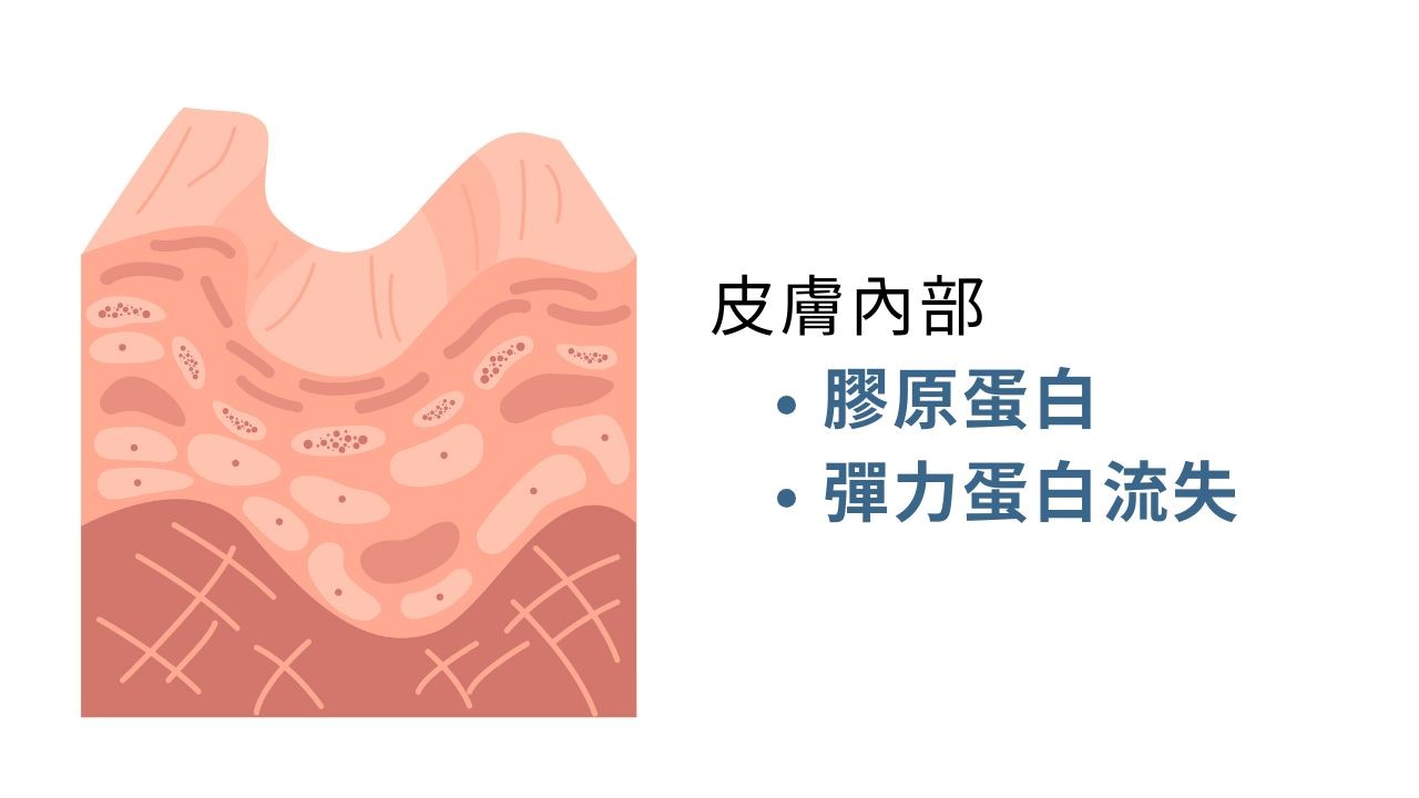 保濕能抗老嗎？抗老成分有哪些？