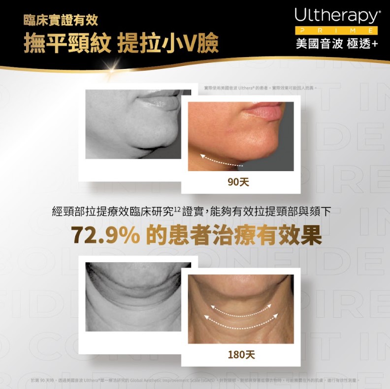眼霜可以擦脖子嗎？如何選對頸紋霜成分？
