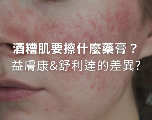酒糟肌要擦什麼藥膏？益膚康與舒利達的差異？