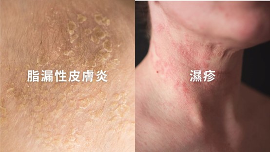 夏天容易脫妝怎麼辦？脫妝怎麼補救？