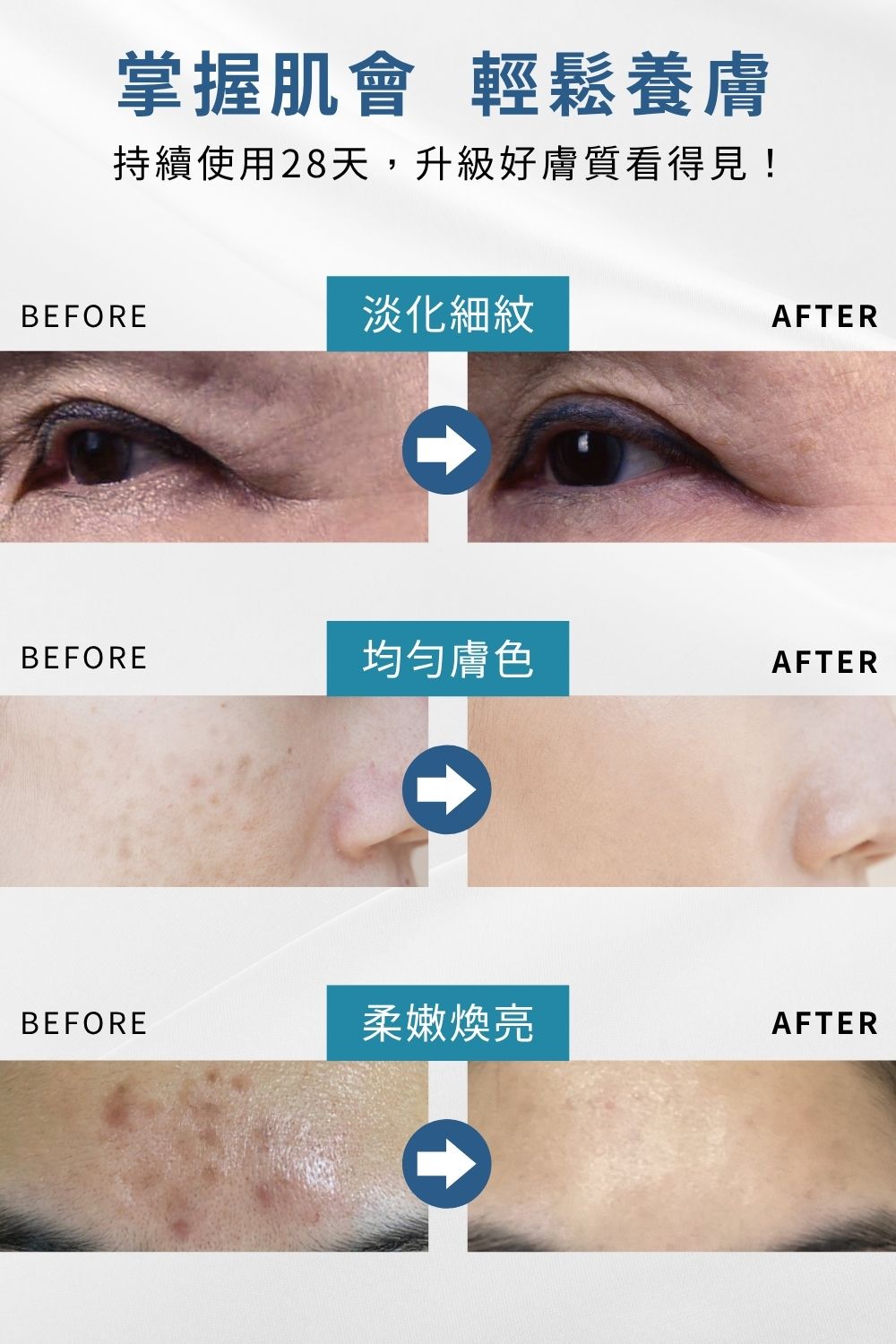 DRX達特仕的莊醫師嚴選活動專區系列-淨白A醛三寶套組，烈日傷害與高溫悶熱的失控膚況，抗老需要多道關鍵程序。痘疤女王莊醫師打造煥膚抗老公式，6倍A醛加再搭配淨顏三程序做好日常清潔調理，讓肌膚重啟障壁，重返青春透亮。