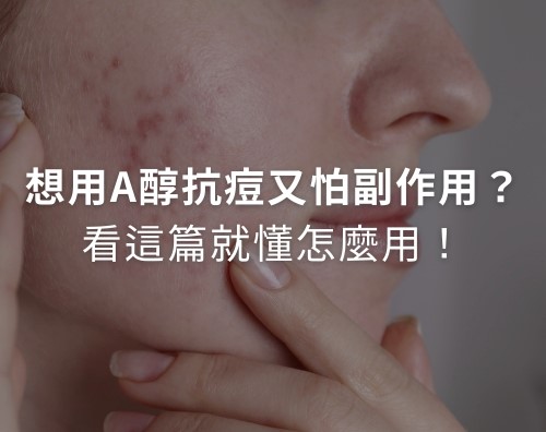 想用A醇改善粉刺、青春痘卻又怕副作用？ 一篇搞懂A醇功效和A醇使用方法！