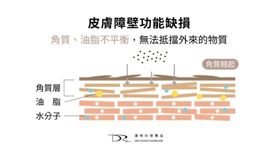 你的臉常出油出到油光四射嗎？過度出油，很多時候帶來的不僅是外觀上油膩膩的困擾，還可能導致一連串的皮膚問題，例如毛孔粗大、蠕形螨蟲增生等等，今天就讓我們來探討出油與不同皮膚問題之間的關聯性吧！