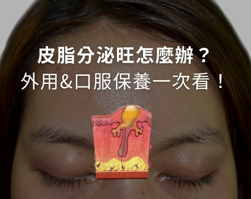 皮脂腺分泌旺盛怎麼辦？外用和口服保養成分介紹！