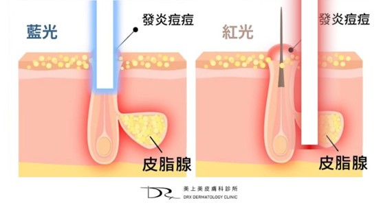 紅光對皮膚好嗎？紅光生髮帽、紅光美容儀有用嗎？