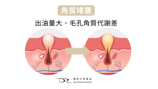 肌膚早晚保養大不同？一篇搞懂原因和早晚該用哪些保養成分！