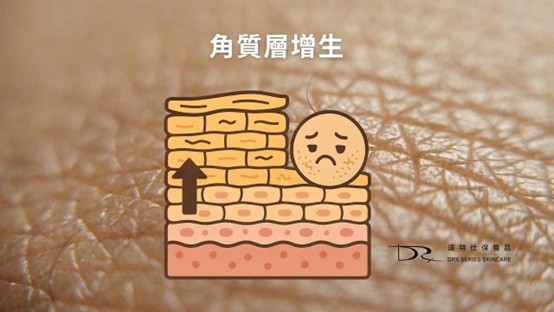 肌膚早晚保養大不同？一篇搞懂原因和早晚該用哪些保養成分！