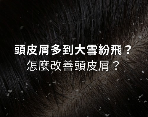 頭皮屑多到大雪紛飛？怎麼改善頭皮屑？