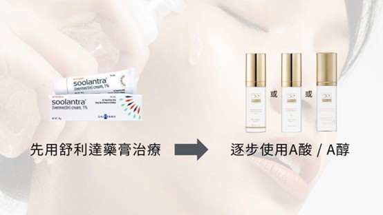 酒糟肌可以擦A醇嗎？敏感肌可以用A醇嗎？