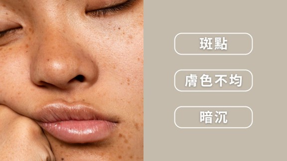 從源頭阻斷黑色素：認識醯本胺(Undecylenoyl Phenylalanine)、怎麼讓酪胺酸酶美白(Tyrosinase)
