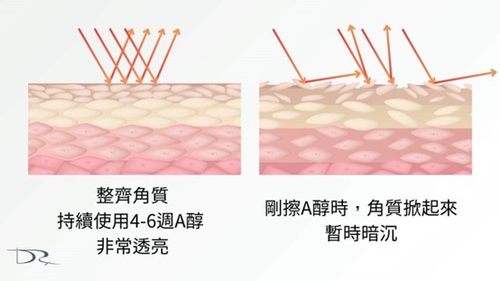 擦A醇反黑怎麼辦？A醇反黑多久？