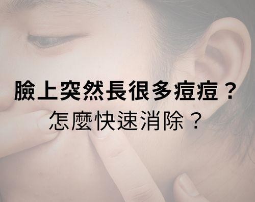 臉上突然長很多痘痘？怎麼快速消除青春痘？