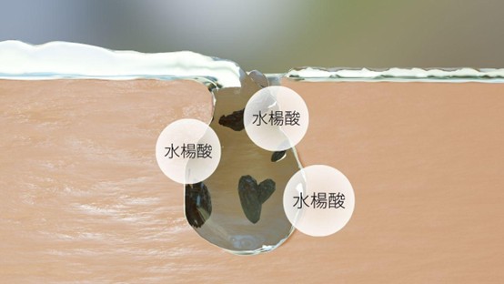 臉上突然長很多痘痘？怎麼快速消除青春痘？