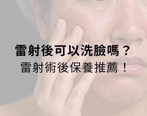 雷射後可以洗臉嗎？雷射術後保養推薦！