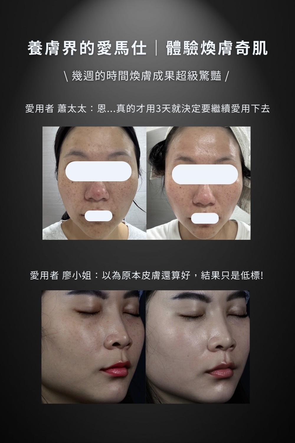 DRX達特仕的乳霜系列-DRX 0.5%維A極淨煥膚亮白乳，針對30歲以上、耐受性肌膚設計的抗老美白A醇。
