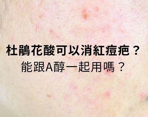 杜鵑花酸可以消紅痘疤嗎？杜鵑花酸可以跟A醇一起用嗎？