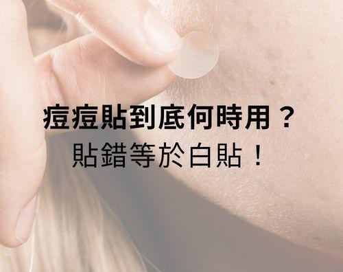 痘痘貼到底何時用？貼錯等於白貼！