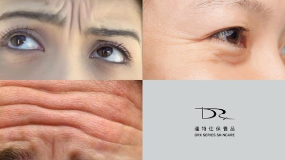 長皺紋的原因？如何讓皺紋變少？