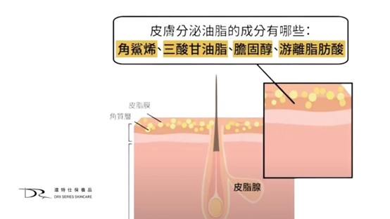 粉刺跟痘痘的差別？粉刺痘痘怎麼消？