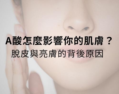 A酸怎麼影響你的肌膚？脫皮與亮膚的背後原因