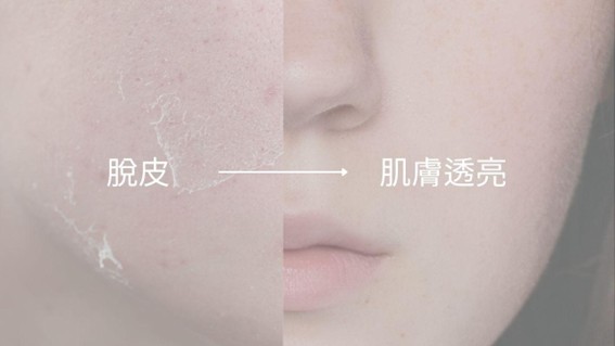 A酸怎麼影響你的肌膚？脫皮與亮膚的背後原因