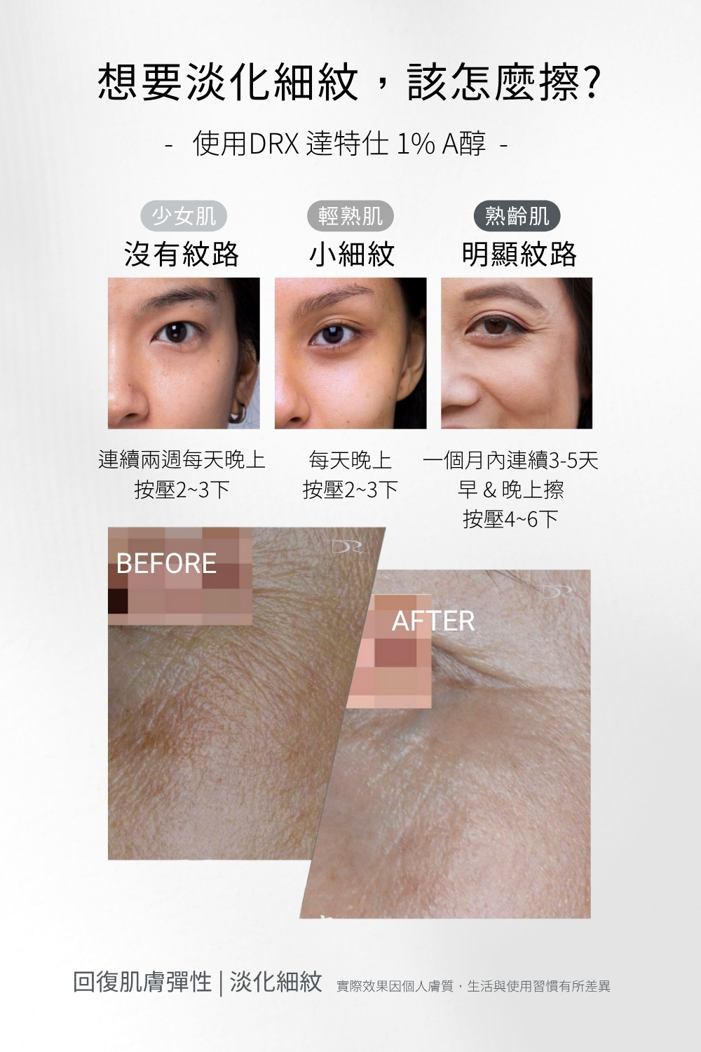 DRX達特仕的依膚質-縮小毛孔系列保養品-DRX 1%煥顏A醇！DRX 1%煥顏A醇，含有高濃度A醇能夠促進肌膚新陳代謝、延緩肌膚衰老，改善膚質粗糙、淡化細紋、淡化皺紋，幫助油性肌膚日常保養！我們給你最好的縮小毛孔系列保養品。