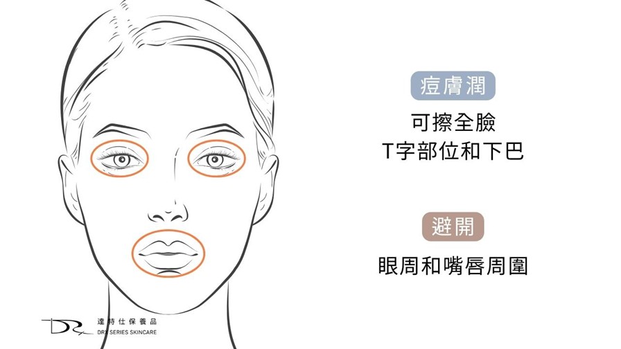 痘膚潤 Differin Gel 的主要成分是 adapalene（阿達帕林），屬於 第三代 A 酸。痘膚潤是少數可在藥局直接購買的 A 酸藥膏。很多人都疑惑痘膚潤的正確用法是什麼? 要如何與其它抗痘保養品搭配，還有順序要怎麼擦呢？