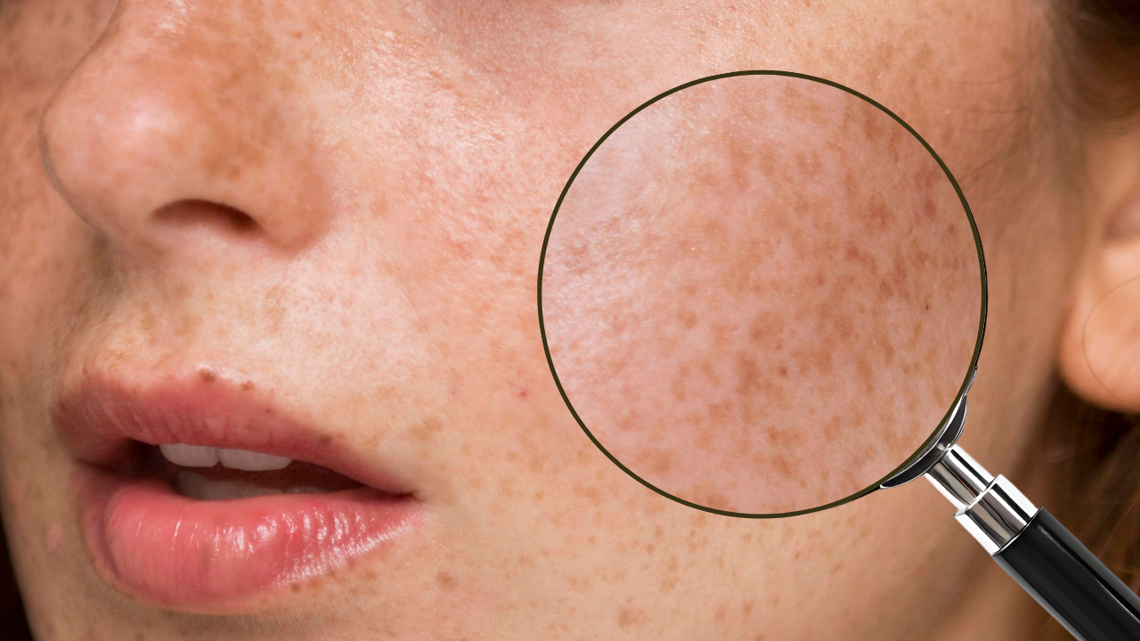 光解酶是什麼?光解酶保養品推薦! 光解酶是什麼?光解酶保養品推薦!