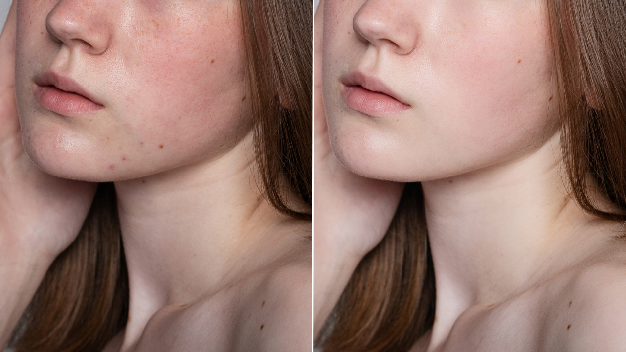 光解酶是什麼?光解酶保養品推薦! 光解酶是什麼?光解酶保養品推薦!