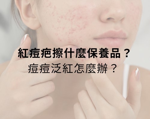 紅痘疤擦什麼保養品?痘痘泛紅怎麼辦? 紅痘疤擦什麼保養品?痘痘泛紅怎麼辦?