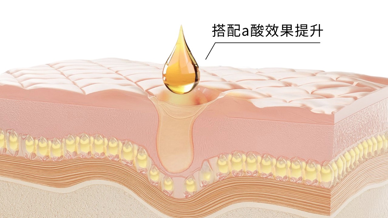 水楊酸擦完要擦什麼？