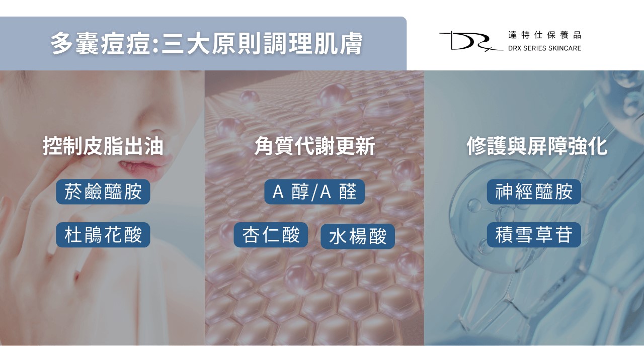 多囊痘痘怎麼辦?PCOS 痘痘原因與保養成分怎麼選 多囊痘痘怎麼辦?PCOS 痘痘原因與保養成分怎麼選