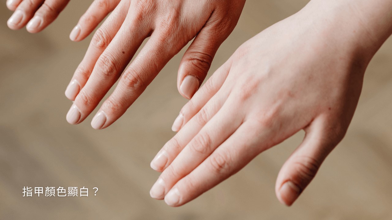 吃什麼變漂亮？掉髮、頭髮乾澀、頭髮變白、臉部暗沉要吃什麼？