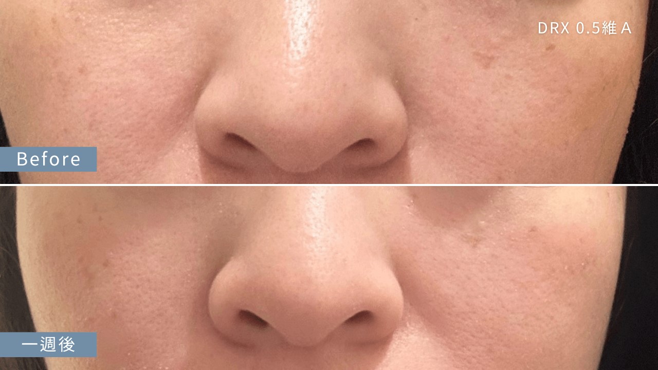 40歲皮膚保養，小腿乾燥怎麼辦？為什麼手看起來很老？