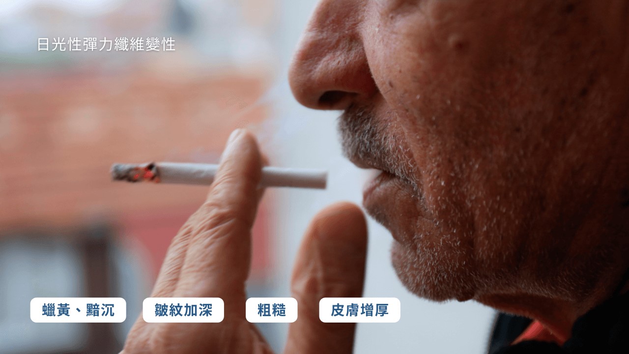 空氣不好會長痘痘嗎？室內空污會漲黑斑、讓皺紋會變多？