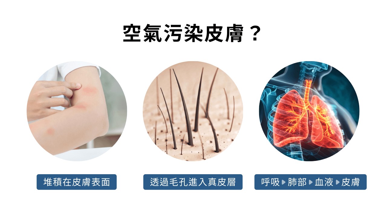 空氣不好會長痘痘嗎？室內空污會漲黑斑、讓皺紋會變多？