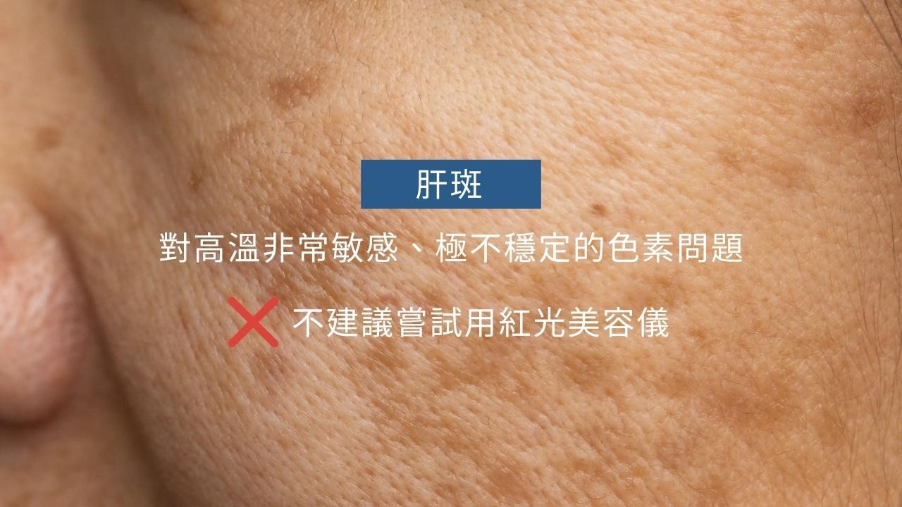 美容儀有用嗎？