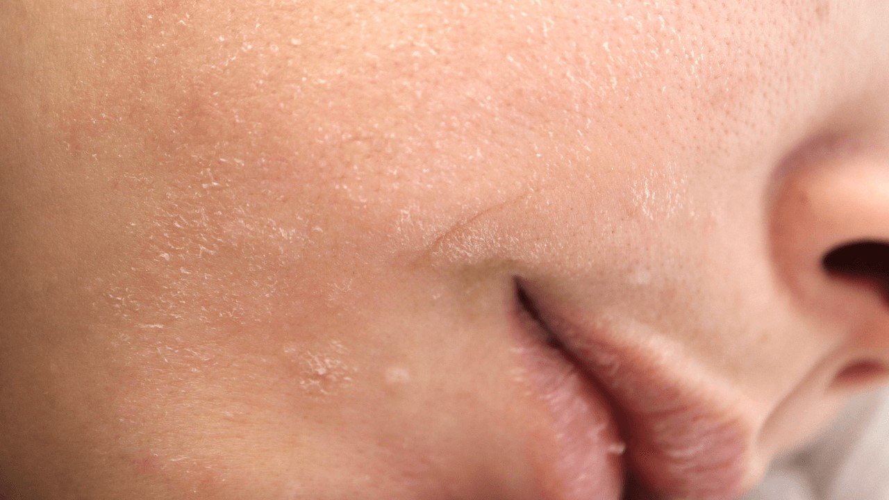 冬天要保濕嗎？乾冷、濕冷保養步驟大公開！